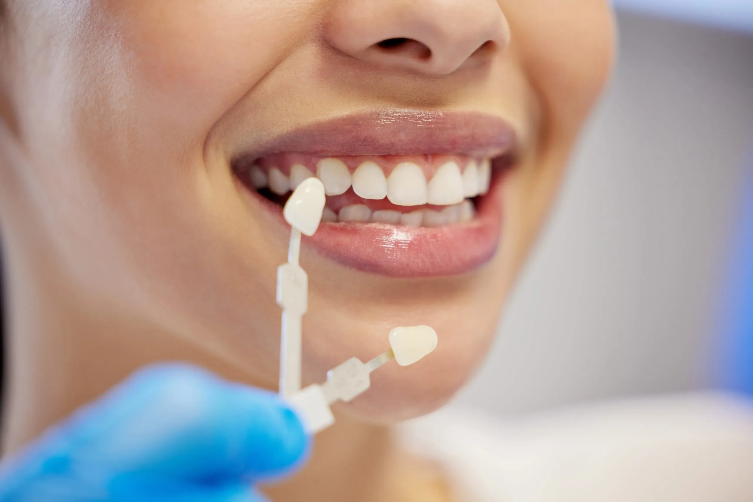 veneers missing teeth